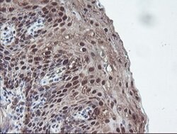 CBR3 Monoclonal Antibody (OTI1G6), TrueMAB , OriGene 100 &mu;L; Unconjugated:Antibodies,