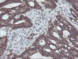 CBR3 Monoclonal Antibody (OTI1G6), TrueMAB , OriGene 100 &mu;L; Unconjugated:Antibodies,