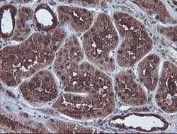 CBR3 Monoclonal Antibody (OTI1G6), TrueMAB , OriGene 100 &mu;L; Unconjugated:Antibodies,