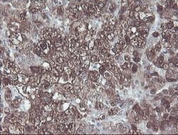 CBR3 Monoclonal Antibody (OTI1G6), TrueMAB , OriGene 100 &mu;L; Unconjugated:Antibodies,