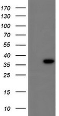 CBR3 Monoclonal Antibody (OTI1G6), TrueMAB , OriGene 100 &mu;L; Unconjugated:Antibodies,
