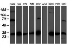 CBR3 Monoclonal Antibody (OTI1G6), TrueMAB , OriGene 100 &mu;L; Unconjugated:Antibodies,