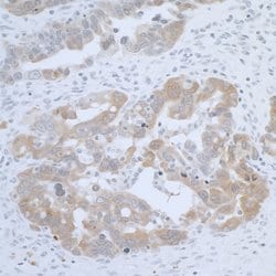 CBS Rabbit anti-Human, Polyclonal, Bethyl Laboratories 100 &mu;L; Unconjugated:Antibodies,