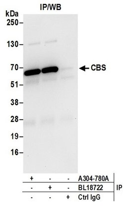 CBS Rabbit anti-Human, Polyclonal, Bethyl Laboratories 100 &mu;L; Unconjugated:Antibodies,