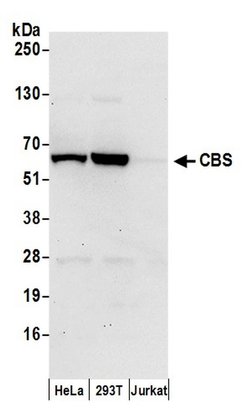 CBS Rabbit anti-Human, Polyclonal, Bethyl Laboratories 100 &mu;L; Unconjugated:Antibodies,