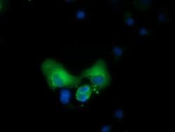 CBWD1 Monoclonal Antibody (OTI5H2), TrueMAB , OriGene 100 &mu;L; Unconjugated:Antibodies,