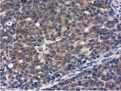 CBWD1 Monoclonal Antibody (OTI3A11), TrueMAB , OriGene 30 &mu;L; Unconjugated:Antibodies,