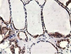 CBWD1 Monoclonal Antibody (OTI3A11), TrueMAB , OriGene 30 &mu;L; Unconjugated:Antibodies,
