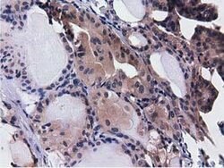 CBWD1 Mouse anti-Human, Clone: OTI3A11, lyophilized, TrueMAB 100 &mu;g;