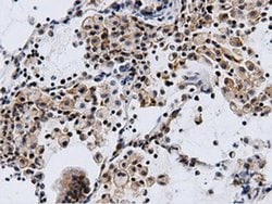 CBWD1 Monoclonal Antibody (OTI3F9), TrueMAB , OriGene:Antibodies:Primary