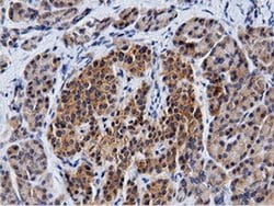 CBWD1 Monoclonal Antibody (OTI3F9), TrueMAB , OriGene 100 &mu;L; Unconjugated:Antibodies,