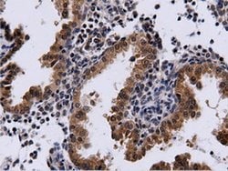CBWD1 Monoclonal Antibody (OTI3F9), TrueMAB , OriGene 100 &mu;L; Unconjugated:Antibodies,