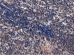CBWD1 Monoclonal Antibody (OTI3F9), TrueMAB , OriGene 100 &mu;L; Unconjugated:Antibodies,