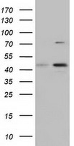 CBWD1 Monoclonal Antibody (OTI4E8), TrueMAB , OriGene 100 &mu;L; Unconjugated:Antibodies,