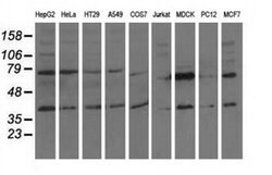 CBWD1 Monoclonal Antibody (OTI4E8), TrueMAB , OriGene 100 &mu;L; Unconjugated:Antibodies,