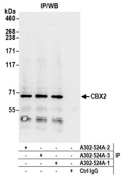 CBX2 Rabbit anti-Human, Polyclonal, Bethyl Laboratories 100 &mu;L; Unconjugated:Antibodies,