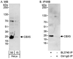 CBX5 Rabbit anti-Human, Polyclonal, Bethyl Laboratories 100 &mu;L; Unconjugated:Antibodies,
