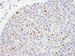 CBX5 Polyclonal Antibody, Bethyl Laboratories 10 &mu;L; Unconjugated:Antibodies,