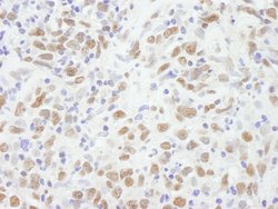 CBX5 Polyclonal Antibody, Bethyl Laboratories 10 &mu;L; Unconjugated:Antibodies,
