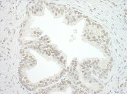 CBX7 Polyclonal Antibody, Bethyl Laboratories 100 &mu;L; Unconjugated:Antibodies,