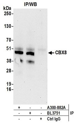 CBX8 Rabbit anti-Human, Polyclonal, Bethyl Laboratories 100 &mu;L; Unconjugated:Antibodies,