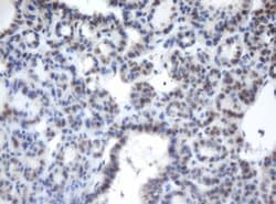 CBX8 Monoclonal Antibody (OTI3A11), TrueMAB , OriGene 100 &mu;L; Unconjugated:Antibodies,