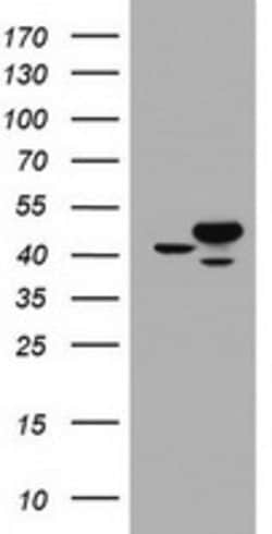 CBX8 Mouse anti-Human, Clone: OTI6D9, lyophilized, TrueMAB 100 &mu;g; Unconjugated:Antibodies,