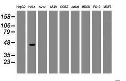 CBX8 Mouse anti-Human, Clone: OTI6D9, lyophilized, TrueMAB 100 &mu;g; Unconjugated:Antibodies,