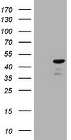 CBX8 Monoclonal Antibody (OTI2C8), TrueMAB , OriGene 100 &mu;L; Unconjugated:Antibodies,