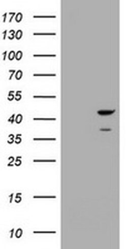 CBX8 Monoclonal Antibody (OTI2A5), TrueMAB , OriGene 100 &mu;L; Unconjugated:Antibodies,