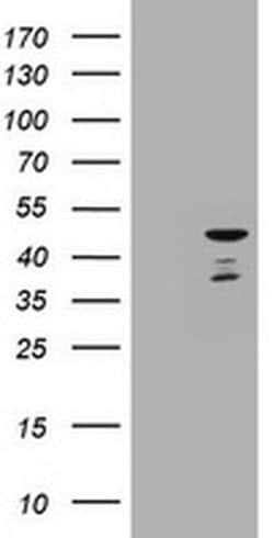 CBX8 Monoclonal Antibody (OTI3D1), TrueMAB , OriGene:Antibodies:Primary