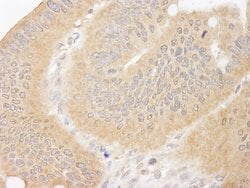 CC2D1A Rabbit anti-Human, Mouse, Polyclonal, Bethyl Laboratories 100 &mu;L;