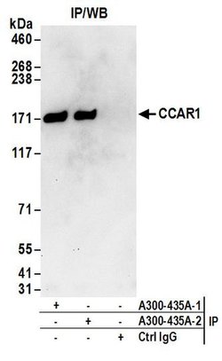 CCAR1 Rabbit anti-Human, Mouse, Polyclonal, Bethyl Laboratories 100 &mu;L;