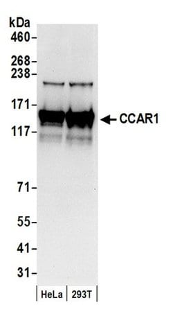 CCAR1 Polyclonal Antibody, Bethyl Laboratories 20 &mu;L; Unconjugated:Antibodies,