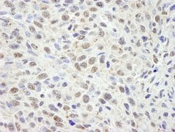 CCAR1 Polyclonal Antibody, Bethyl Laboratories 100 &mu;l; Unlabeled:Antibodies,