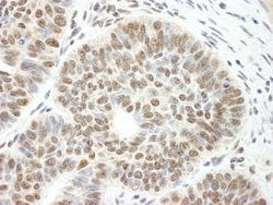 CCAR1 Polyclonal Antibody, Bethyl Laboratories:Antibodies:Primary Antibodies