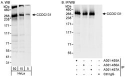 CCDC131 Rabbit anti-Human, Polyclonal, Bethyl Laboratories 100 &mu;L; Unconjugated:Antibodies,