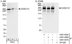 CCDC131 Rabbit anti-Human, Polyclonal, Bethyl Laboratories 100 &mu;l; Unlabeled:Antibodies,