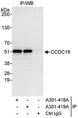 CCDC16 Rabbit anti-Human, Polyclonal, Bethyl Laboratories 10 &mu;L; Unconjugated:Antibodies,