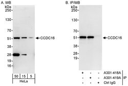 CCDC16 Rabbit anti-Human, Polyclonal, Bethyl Laboratories 100 &mu;L; Unconjugated:Antibodies,