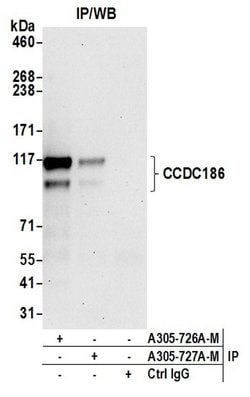 CCDC186 Polyclonal Antibody, Bethyl Laboratories 20 &mu;L | Buy Online | Bethyl Laboratories, Inc | Fisher Scientific