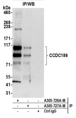 CCDC186 Polyclonal Antibody, Bethyl Laboratories 20 &mu;L; Unconjugated:Antibodies,