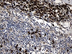 CCDC22 Mouse anti-Human, Clone: OTI2E4, lyophilized, TrueMAB 100 &mu;g;