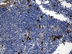 CCDC22 Mouse anti-Human, Clone: OTI2E4, lyophilized, TrueMAB 100 &mu;g;