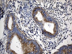 CCDC22 Mouse anti-Human, Clone: OTI5C1, lyophilized, TrueMAB 100 &mu;g;