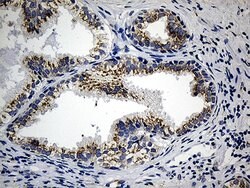 CCDC22 Mouse anti-Human, Clone: OTI5C1, lyophilized, TrueMAB 100 &mu;g;