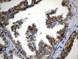 CCDC22 Mouse anti-Human, Clone: OTI5C1, lyophilized, TrueMAB 100 &mu;g;