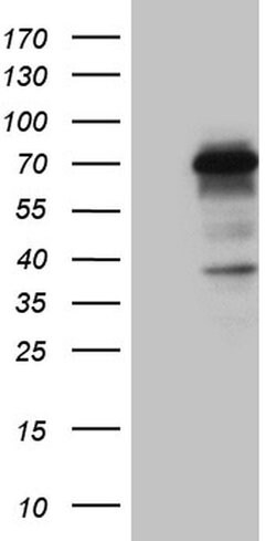 CCDC22 Monoclonal Antibody (OTI2E4), TrueMAB , OriGene 100 &mu;L; Unconjugated:Antibodies,
