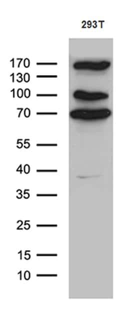 CCDC22 Mouse anti-Human, Clone: OTI2E4, lyophilized, TrueMAB 100 &mu;g;