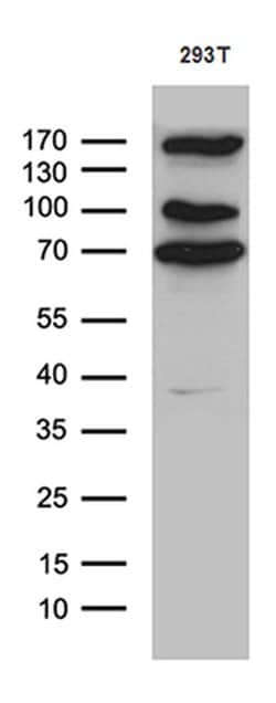 CCDC22 Monoclonal Antibody (OTI2E4), TrueMAB , OriGene 100 &mu;L; Unconjugated:Antibodies,